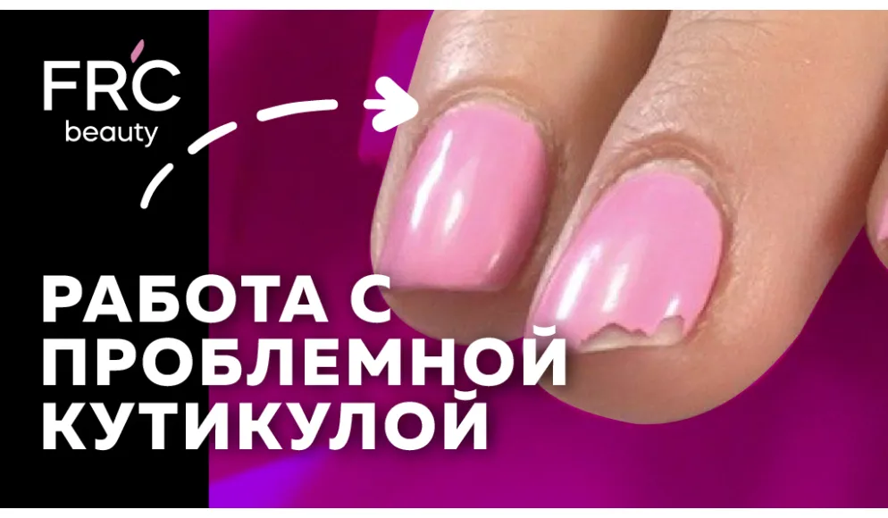 Работа с проблемной кутикулой