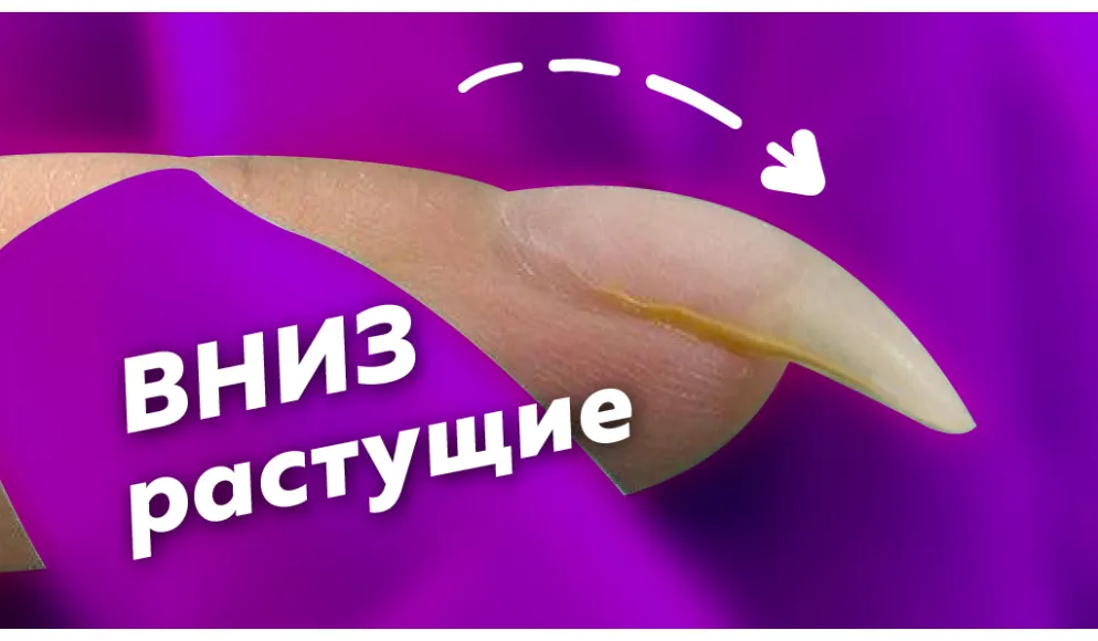 Как поднять клюющий ноготь? Исправляем свободный край. Секреты О