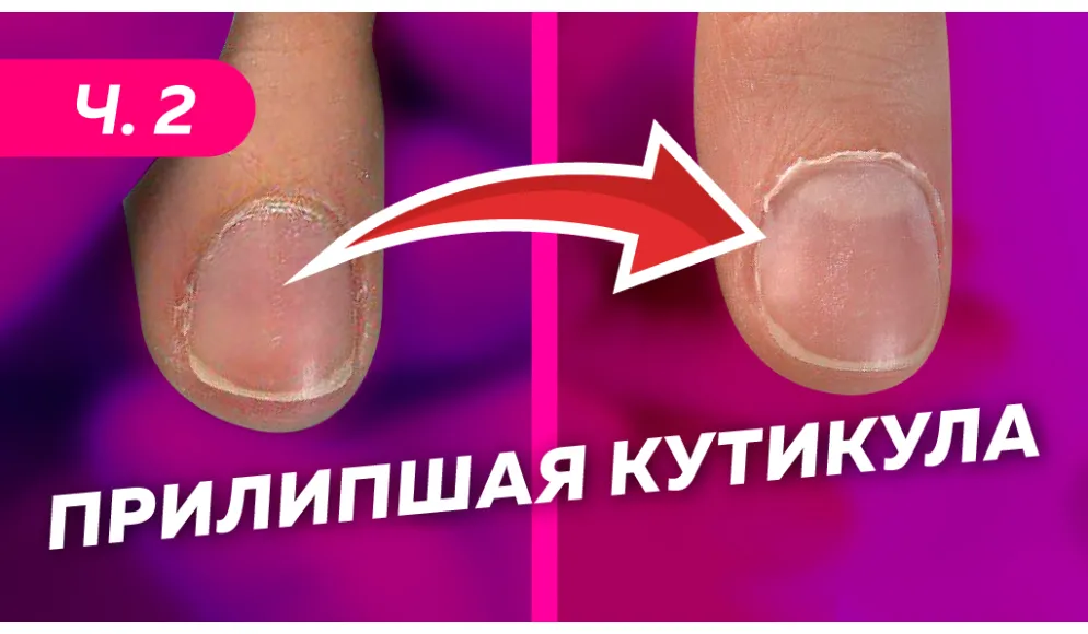 3 техники работы с налипшей кутикулой. Какую выбрать?