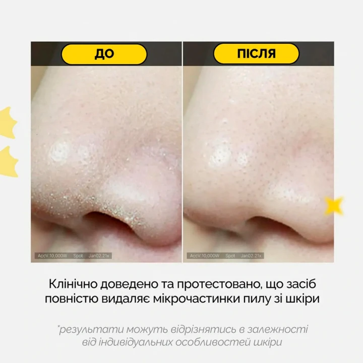 Пінка для глибокого очищення пор Medicube (Zero Foam Cleanser з екстрактом меліси 120 мл)