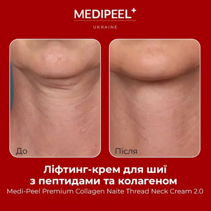 Крем підтягуючий для шиї Medipeel (PREMIUM COLLAGEN NAITE THREAD NECK CREAM 3.0)