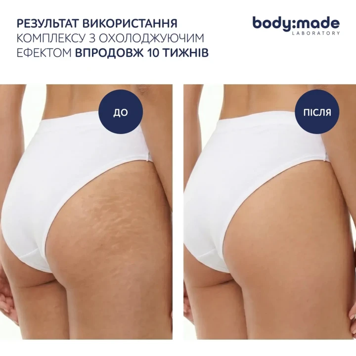 Крем-гель охолоджувальний BodyMade (з антицелюлітним ефектом 200 мл)