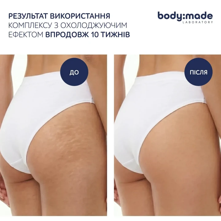 Обгортання бандажне охолоджувальне BodyMade (з антицелюлітним ефектом 2 бинти 150 мл)