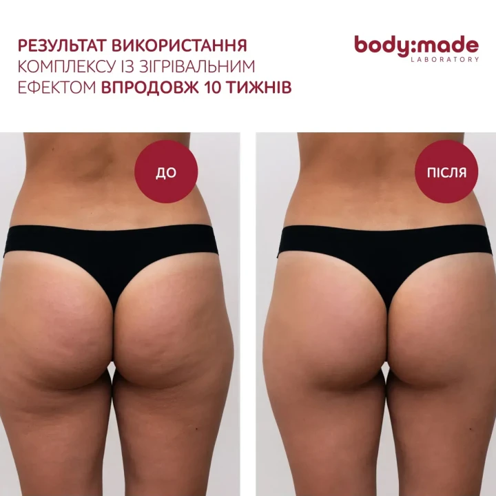 Обгортання бандажне зігрівальне BodyMade (з антицелюлітним ефектом 150 мл)