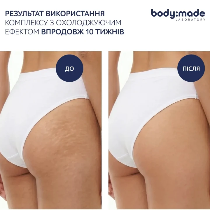 Сироватка охолоджувальна для обгортання BodyMade (з антицелюлітним ефектом 500 мл)