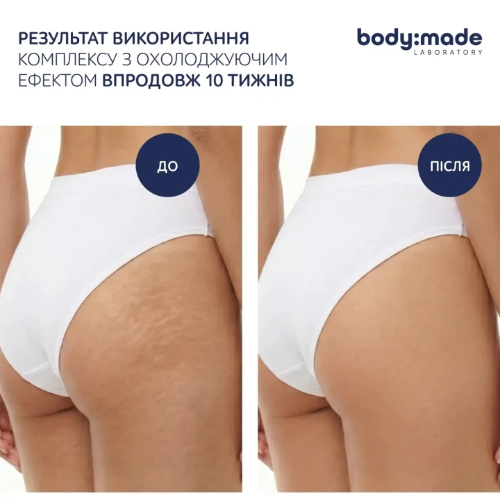 Штани для бандажного обгортання BodyMade (1 шт.)