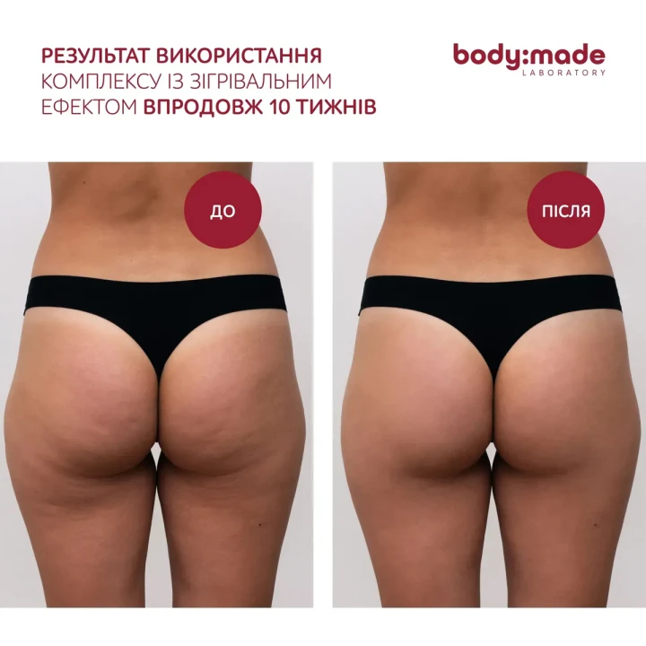 Скребок гуа-ша для массажа тела BodyMade (лимфодренажный 1 шт.)