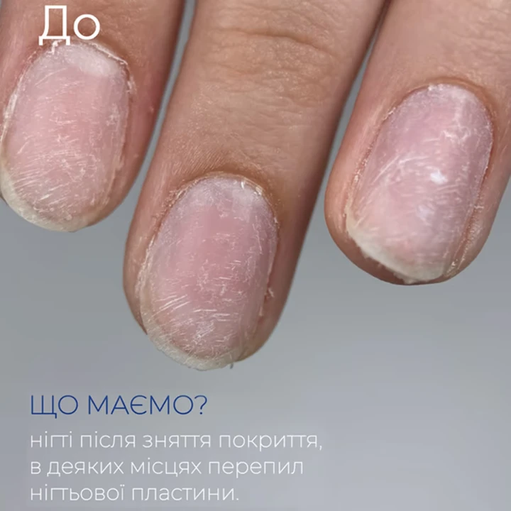Средство восстановительное для ногтей Touch (After gel 8 мл)